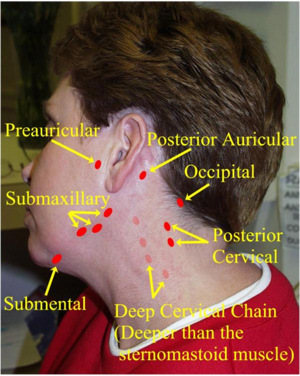 swollen-lymph-nodes-in-neck-causes-and-treatment-hot-sex-picture